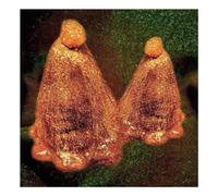 Black to Comm - Oocyte Oil & Stolen Androgens [VINYL]