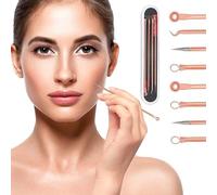 Blackhead Remover Pimple Popping Acne Extraction 4 PCS Tool Set, Blemish Scar Care for Facial Treatment-Stainless Steel Skin Care Comedone Extractor Zit Removing for Nose Face Cheeks(Rosegold)