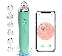 Blackhead Remover Pore Vacuum, Upgraded WiFi Visible Facial Pore Cleanser with HD Camera Pimple Acne Comedone Extractor Kit with 6 Suction Heads USB Rechargeable Electric Black Head Suction Tool