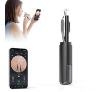 Blackhead Remover Tweezer with 1080P Camera, UV Light - USB Rechargeable Precision Tweezers for Ingrown Hair, Ear Hair, Eyebrows, Pore Extractor Tool for Men and Women (Black)
