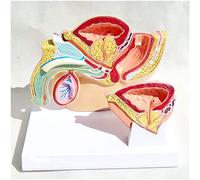 Bladder Anatomical Model - Human Organ Anatomy Model Male Organ Model - Medical Anatomical Normal Hyperplasia Prostate