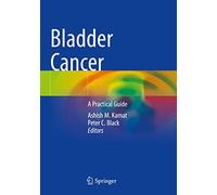 Bladder Cancer: A Practical Guide