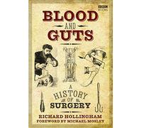 Blood and Guts – A History of Surgery