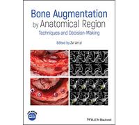 Bone Augmentation by Anatomical Region: Techniques and Decision-Making