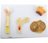 Bone Structure Model Cancellous Compact Bone Human Anatomy Structural Model of Bone Cancellous Bone Dense Bone and Femur System Teaching and Lab Resources