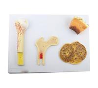 Bone Structure Model Cancellous Compact Bone Human Anatomy Structural Model of Bone Cancellous Bone Dense Bone and Femur System Teaching and Lab Resources