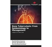 Bone Tuberculosis: From Epidemiology to Management