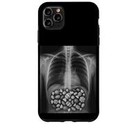 Bone X-Ray Scan Funny Halloween Radiology Technician Case for iPhone 11 Pro Max