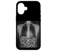 Bone X-Ray Scan Funny Halloween Radiology Technician Case for iPhone 16