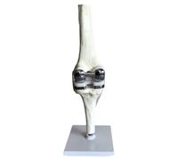Bortivier Knee Joint Model Simulation Replacement Surgery Meniscus Ligament Cartilages Surgery Model,Artificial Knee Joint
