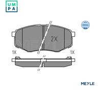 Meyle Brake Pad Set 025 251 8718 – Front Axle for Hyundai/Kia (ix20, Soul, Sonata)