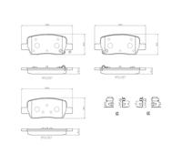 BREMBO P 30 141 Brake pad set