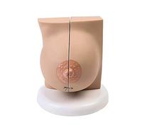 Breast Anatomical Model Human Organ Anatomy Model Female Breast Model Medical Anatomical Pathological Breast Cross Section Anatomical Model Study Teaching Medical Model(C)