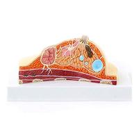 Breast Anatomy Model,Human Breast Pathology Breast Augmentation Beauty Model Gynecological Model Teaching 16 X 12 X7.5 Cm