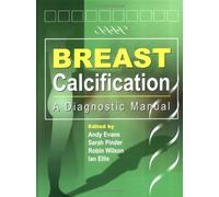 Breast Calcification: A Diagnostic Manual