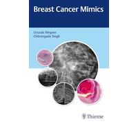 Breast Cancer Mimics