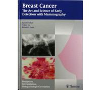 Breast Cancer: The Art and Science of Early Detection with Mammography (Tabar Mammo)