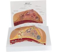 Breast Cross-Section Model, Female pathology Breast Model, Female Breast Pathology Medical Teaching Model, for Doctor's Offices and Classrooms