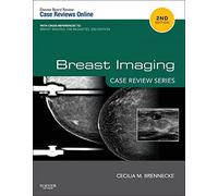 Breast Imaging: Case Review Series