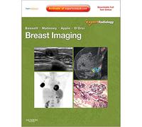 Breast Imaging: Expert Radiology Series