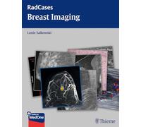 Breast Imaging (Radcases Plus Q&A)