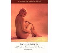 Breast Lumps: A Guide to Diseases of the Breast