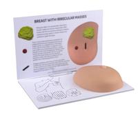 Breast Model for Self-Examination - Anatomical Silicone Manikin with Cancer Pathological Lumps for Doctor-Patient Communication