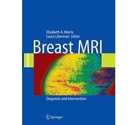 Breast MRI: Diagnosis and Intervention
