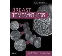 Breast Tomosynthesis