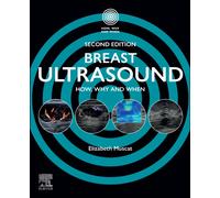 Breast Ultrasound : How, Why and When