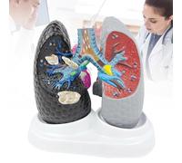 Breathing Lung Model and Bronchial Teaching Aids, Healthy vs. Smoking Lung Comparison Demonstration, Human Respiratory System Educational Model