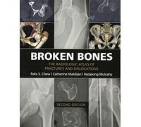 Broken Bones: The Radiologic Atlas of Fractures and Dislocations