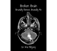 Broken Brain: Brutally Honest, Brutally Me