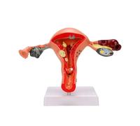 Brrnoo Female Pathological Uterus Ovary Anatomical Model PVC Human Uterus Model for Education Study Teaching Nursing Education for Biology
