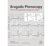 Brugada Phenocopy: The Art of Recognizing the Brugada ECG Pattern