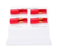 Buachois Human Atherosclerosis Model, Atherosclerotic Artery Display Demonstration Teaching Aid Educational Tool ABS for Classrooms Laboratories