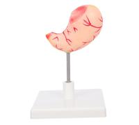 BUGUUYO Human Stomach Anatomy Model for Education Realistic Stomach Dissection Model with Detailed Structure Sturdy Construction Medical Teaching Tool for Science Classrooms and Clinical