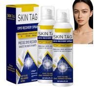 Bump Renewal Spray, Soothing and Hydrating Herbs Spray, Natural Ingredients Wart Removal Mist for Skin Tags Imperfections Suitable for All Skin Types cooling wart removal (2pcs)