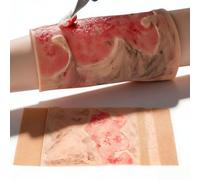 Burn Wound Model,2-3 Degree Burn Wound Trainer for Nursing Training - Wearable Limb Burns Simulator, Bleeding Control & Wounds Care Practice for Nurses, Medical Education Demonstration