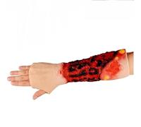 Burn Wound Model, Wearable Silicone Arm Burns Simulator, Realistic Arm Sleeve Burn Simulator, for Medical Education Demonstration and Wound Care Practice.