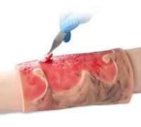 Burn Wound Model, Wearable Silicone Limb Burns Simulator, 2-3 Degree Limb Burns Training Module for Care, Medical Teaching Demonstration.