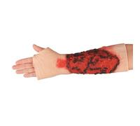 Burn Wound Training Model, Wearable Sleeve for 3rd Degree Limb Burns, Realistic Simulated Design for Wound Care and Fire Safety Training, Essential Medical Training Tool