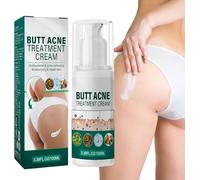 Butt Acne Cream,Butt Acne Treatment,Acne Treatment Cream,Butts Acne Clearing Treatment Cream,Butts Pimple Removing Cream,Butts Acne Clearing Spot Treatment Cream,Thigh Acne Treatment