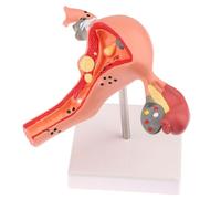 buyzg Female Uterus and Ovary Anatomy Model Detailed Pathology Teaching Aid for Human Reproductive Health and Disease Dissection