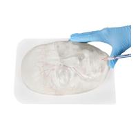 buyzg Injectable Facial Model,Transparent Injection Face Model with Blood Vessels for Micro Plastic Surgery Practice Cosmetic Injection Instruction