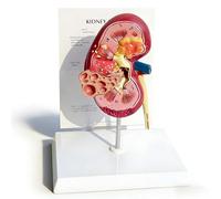 buyzg Kidney Anatomy Model, Life-Size Normal and Pathological Kidney Models for Medical Learning,Kidneys Human Anatomy Replica for Doctors Office Educational Tool