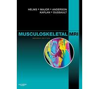 By Clyde A. Helms - Musculoskeletal MRI: 2nd (second) Edition