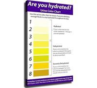 BYLSAGWHT Educational Wellness Poster Hydration Chart Body Signals Informative Wall-Art for Home Office Bathroom Decor Health Tracking