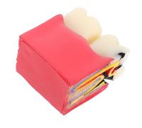 Cabilock Comparative Caries Anatomy Model: Tooth Decay Teaching Education Model Tool for Classrooms Students Dentists Patient Learning Supplies