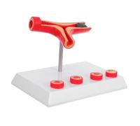Cabilock High Vessel Model for Medical Teaching Realistic Vascular Blockage Simulation Pathological Insight for Clinical Education and Research